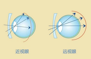 青少年视力养护的好处和重要性